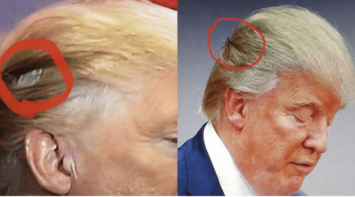 The Evolution of Trump's Hair - wide 1